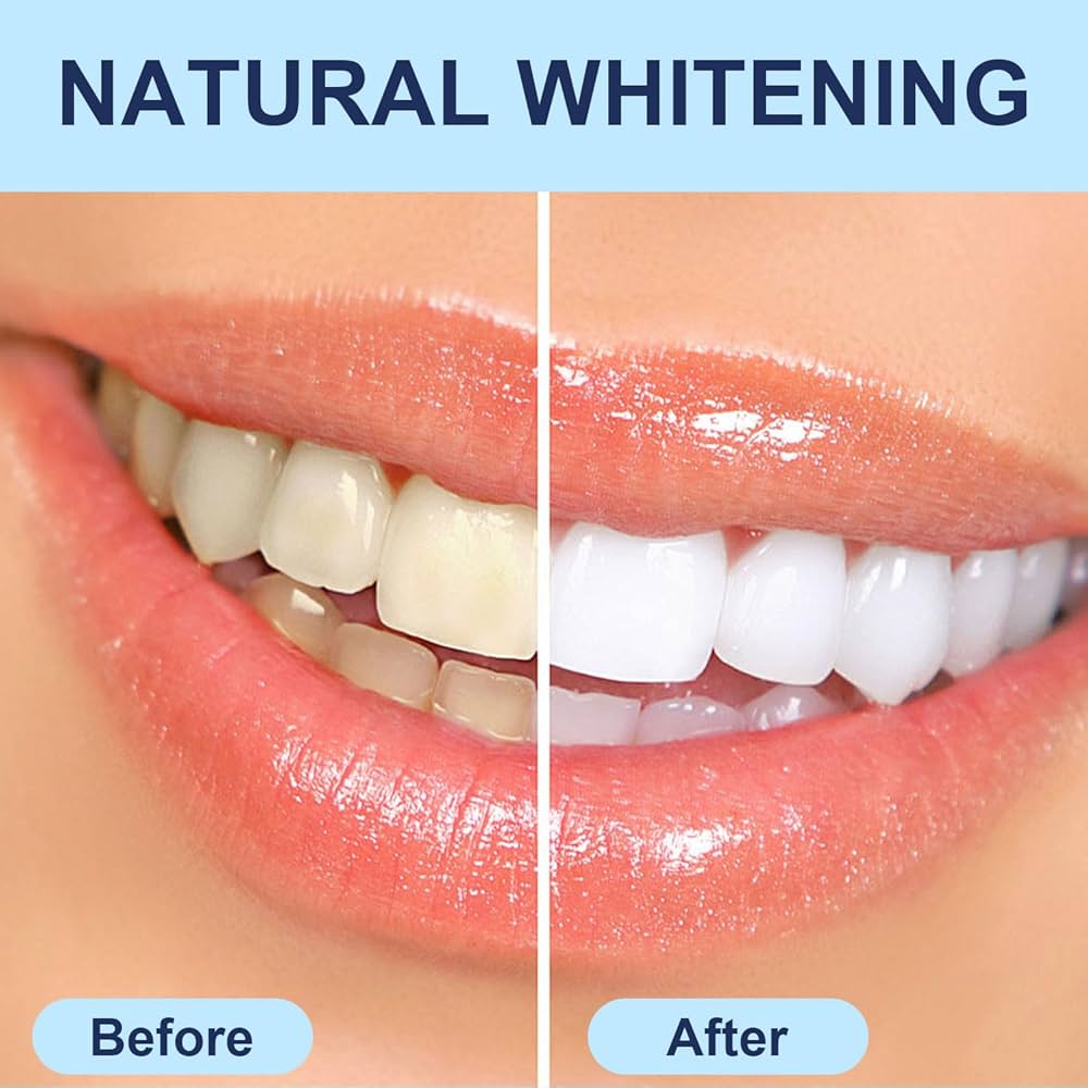 Dr. Dent Teeth Whitening Strips 42 (21 treatments)