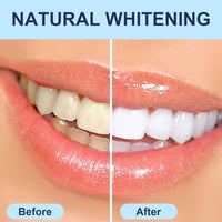 Dr. Dent Teeth Whitening Strips 42 (21 treatments)